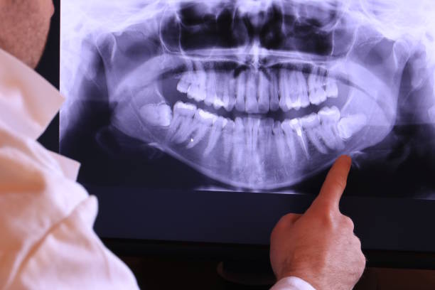 Best Broken Tooth Emergency  in Vineyard Haven, MA